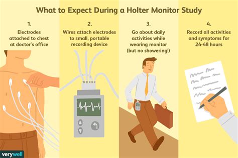 holter monitor results example|Holter Monitor Test: Uses, Risks, Procedure, Results.